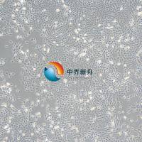 4T1小鼠乳腺癌细胞