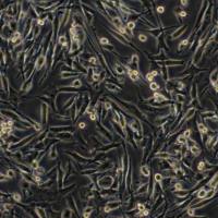 大鼠肝癌细胞(CBRH-7919)