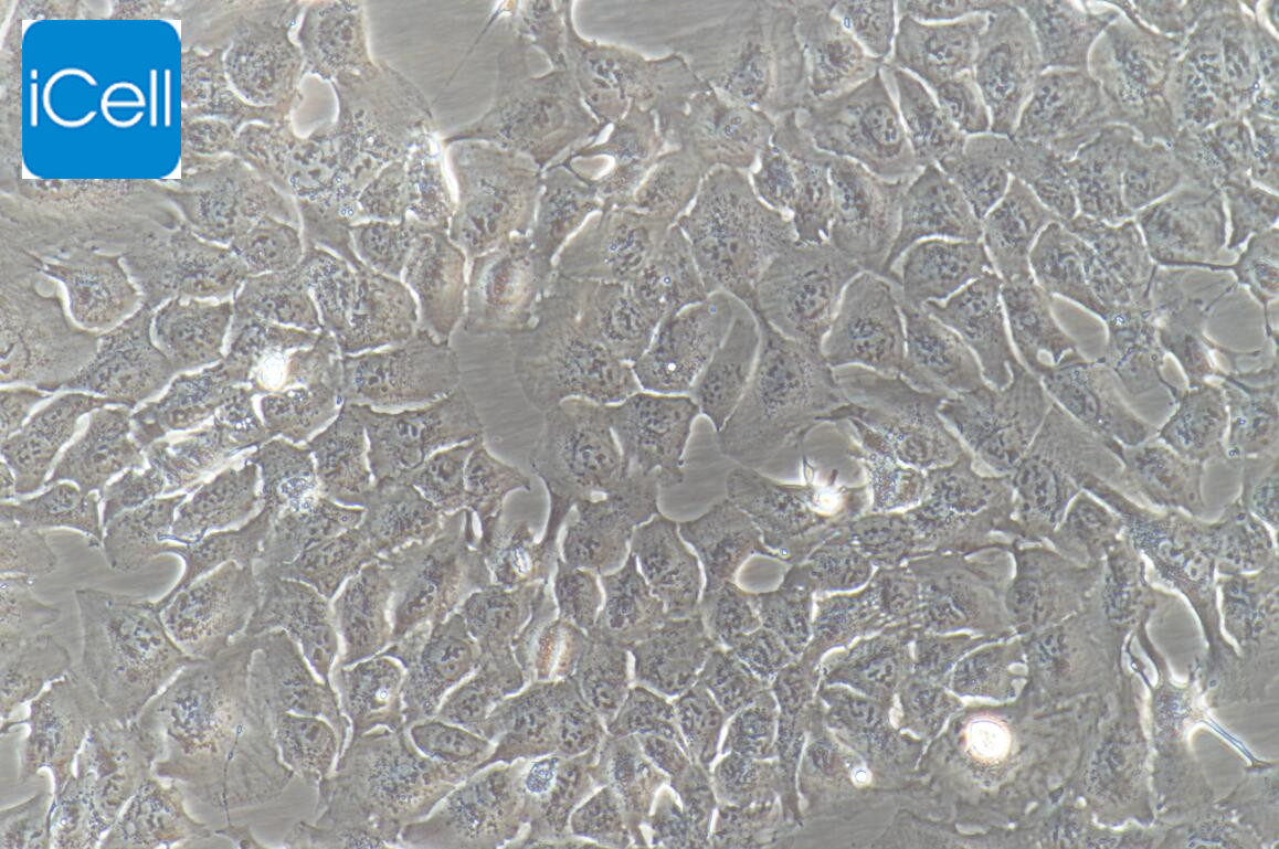 RBE、RBE细胞、RBE细胞、人肝胆管癌细胞/STR鉴定