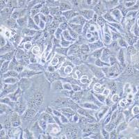 HCC1806、HCC1806细胞、HCC-1806细胞、HCC-1806、人乳腺鳞状癌细胞、STR鉴定