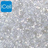 MDA-MB-435s、MDA-MB-435s细胞、MDAMB435s细胞、MDAMB435s、人乳腺癌细胞/STR鉴定/镜像绮点