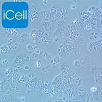 MDA-MB-415、MDA-MB-415细胞、MDAMB415细胞、MDAMB415、人乳腺腺癌细胞/STR鉴定/镜像绮点(Cellverse)
