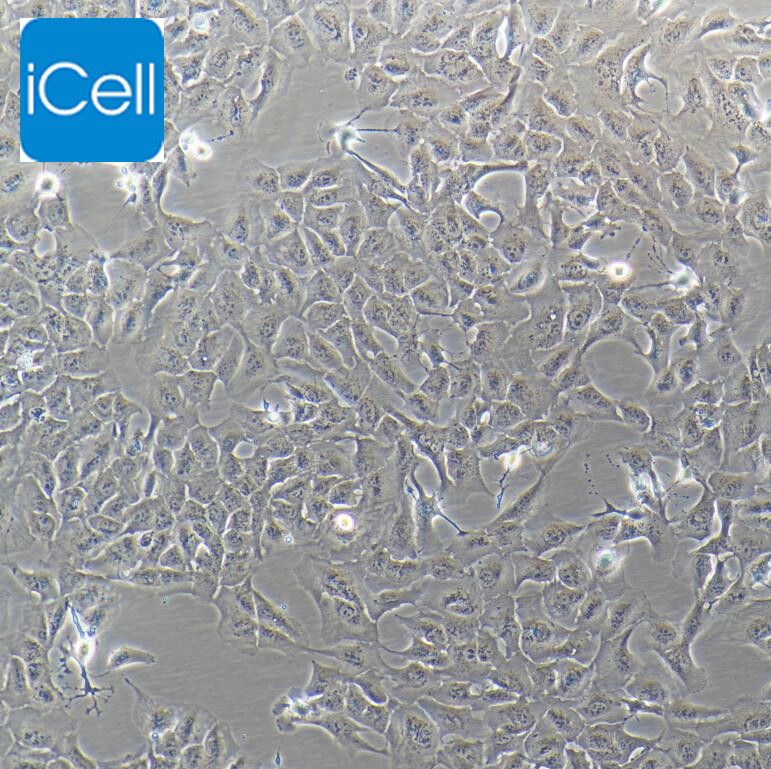 RBE、RBE细胞、RBE细胞、人肝胆管癌细胞/STR鉴定