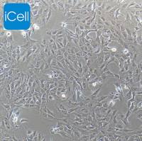 RBE、RBE细胞、RBE细胞、人肝胆管癌细胞/STR鉴定