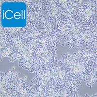 INS-1、INS-1细胞、INS1细胞、INS1、大鼠胰岛细胞瘤细胞/STR鉴定/镜像绮点