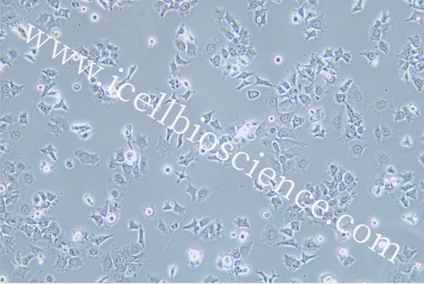 HCC1588 | HCC1588细胞 | HCC-1588