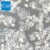 PC-9  |  PC-9细胞  |  PC9细胞  |  PC9  |  PC9人