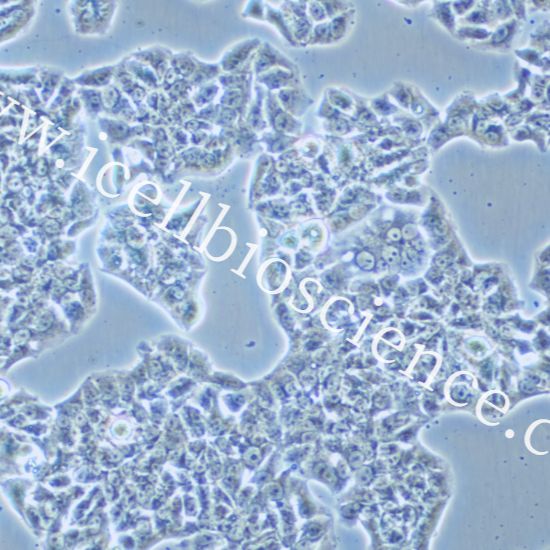 HCC1833、HCC1833细胞、HCC-1833细胞、HCC-1833、人肺癌腺癌细胞/STR鉴定/镜像绮点（Cellverse）