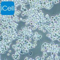 MKN-45、MKN-45细胞、MKN45细胞、MKN45人胃癌细胞/种属鉴定/镜像绮点