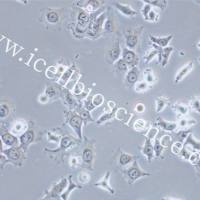 HCC1588 | HCC1588细胞 | HCC-1588细胞 | HCC-1588 | 人肺