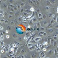 TE-1人食管癌细胞