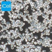 MDA-MB-453、MDA-MB-453细胞、MDAMB453细胞、MDAMB453人乳腺癌细胞/STR鉴定/镜像绮点（Cellverse）