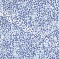 293T/17、293T/17细胞、293T-17细胞、293T-17、人胚肾细胞/STR鉴定