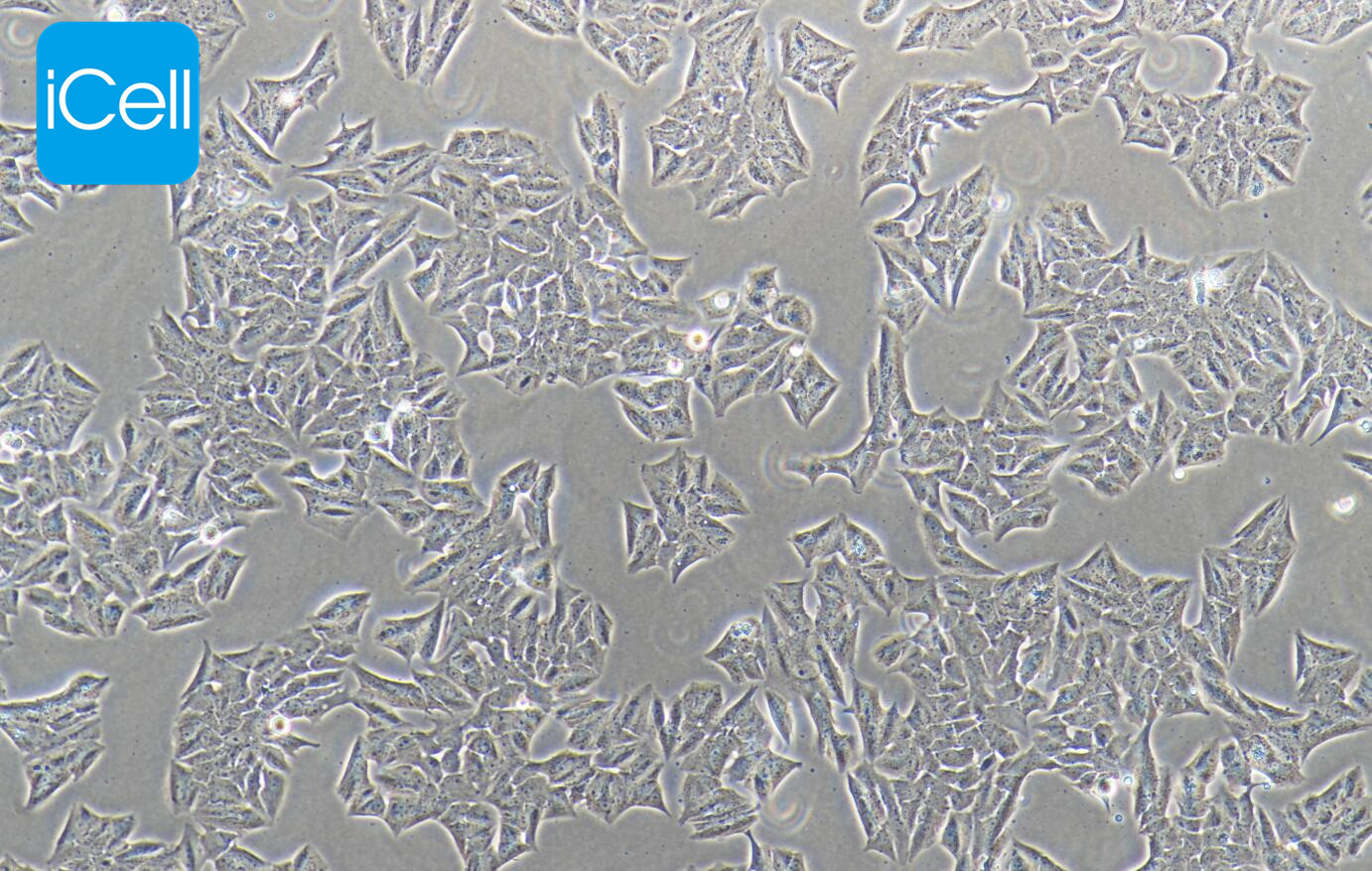 MDA-MB-361、MDA-MB-361细胞、MDAMB3