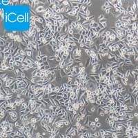 Bel-7402、Bel-7402细胞、Bel7402细胞、Bel7402、人肝癌细胞/STR鉴定