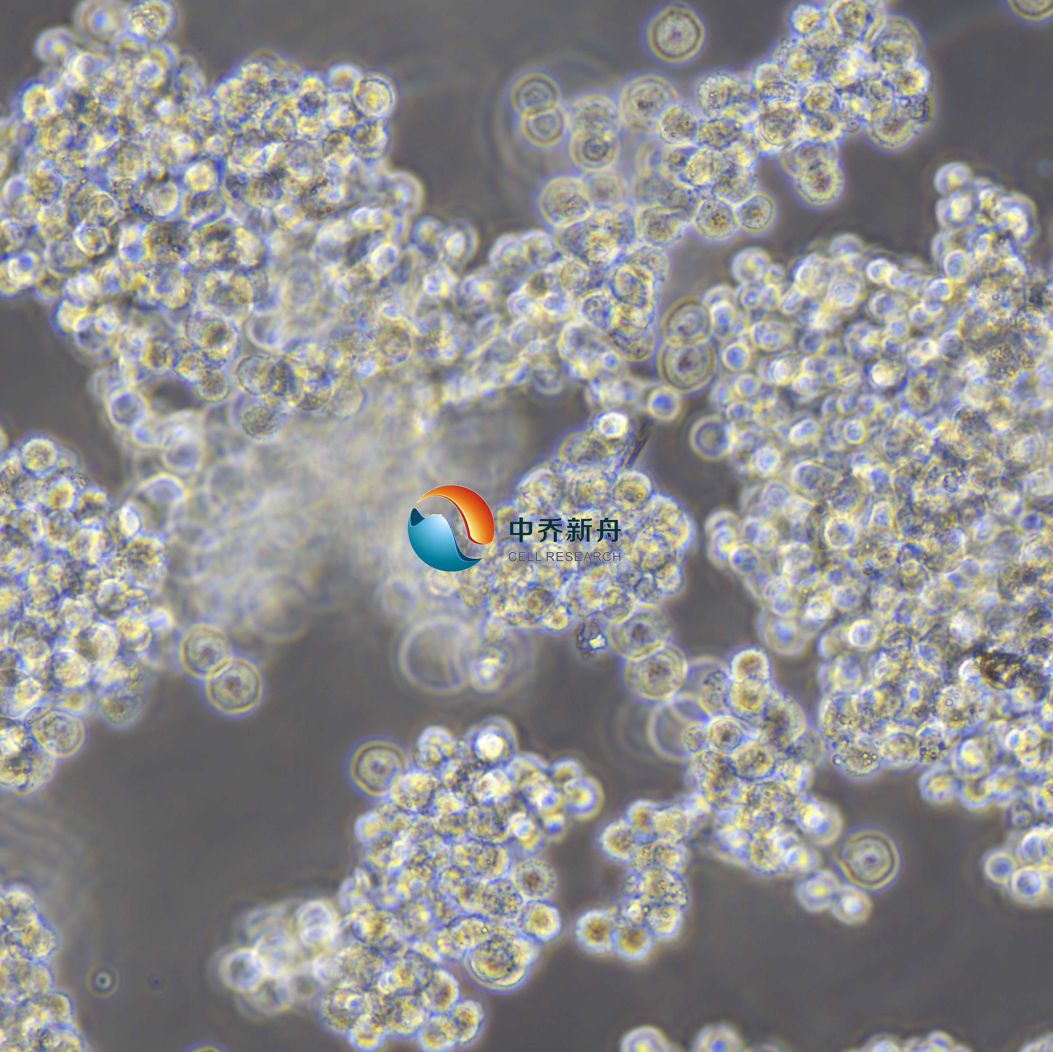 SNU-1人胃癌细胞