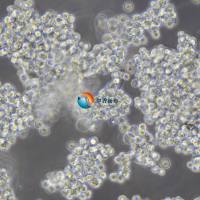 SNU-1人胃癌细胞