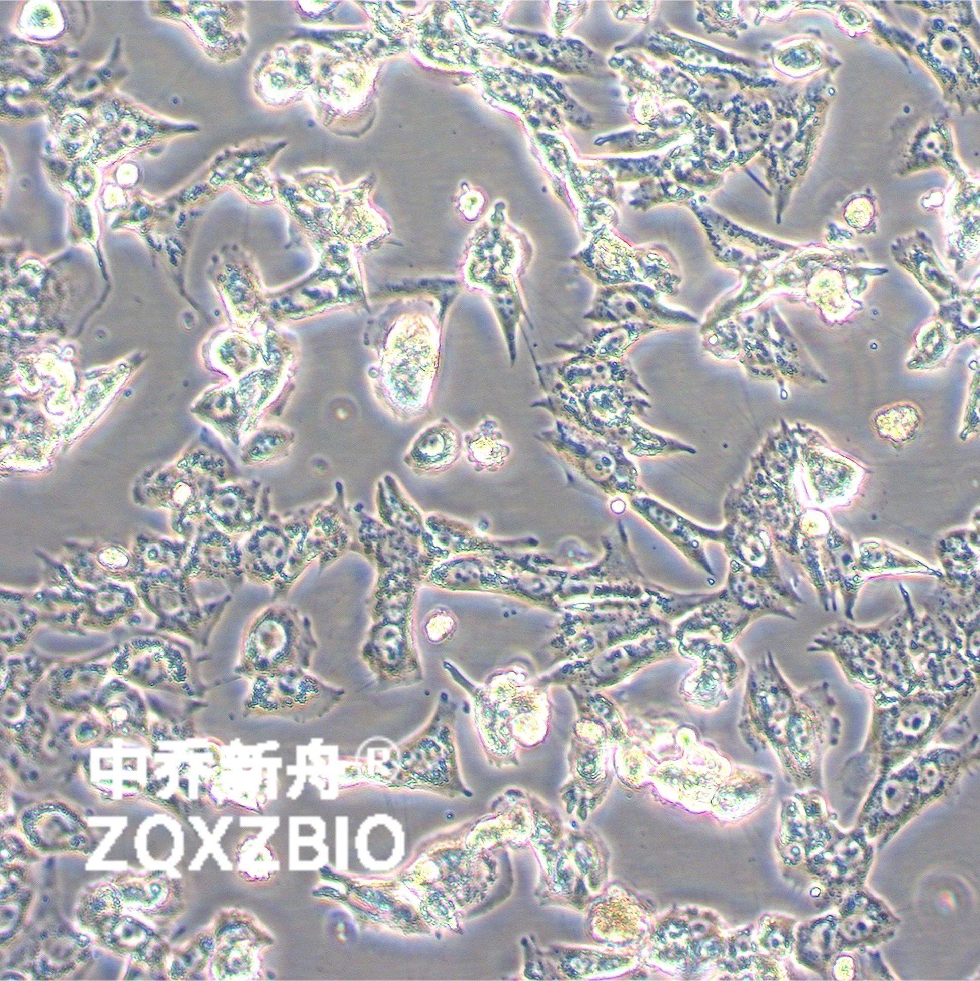 BHT101人甲状腺癌细胞