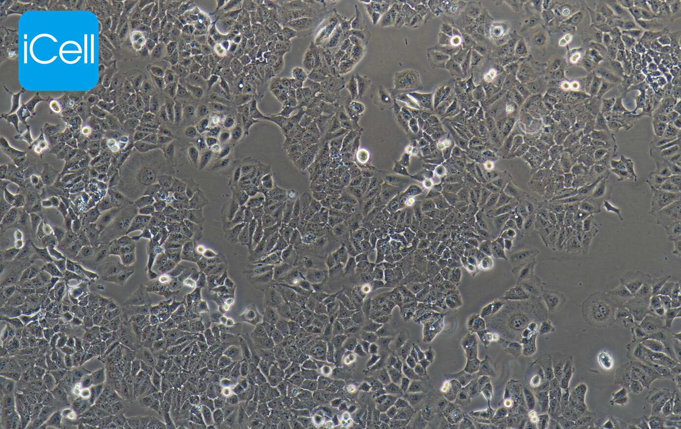 Ishikawa、Ishikawa细胞、Ishikawa细胞