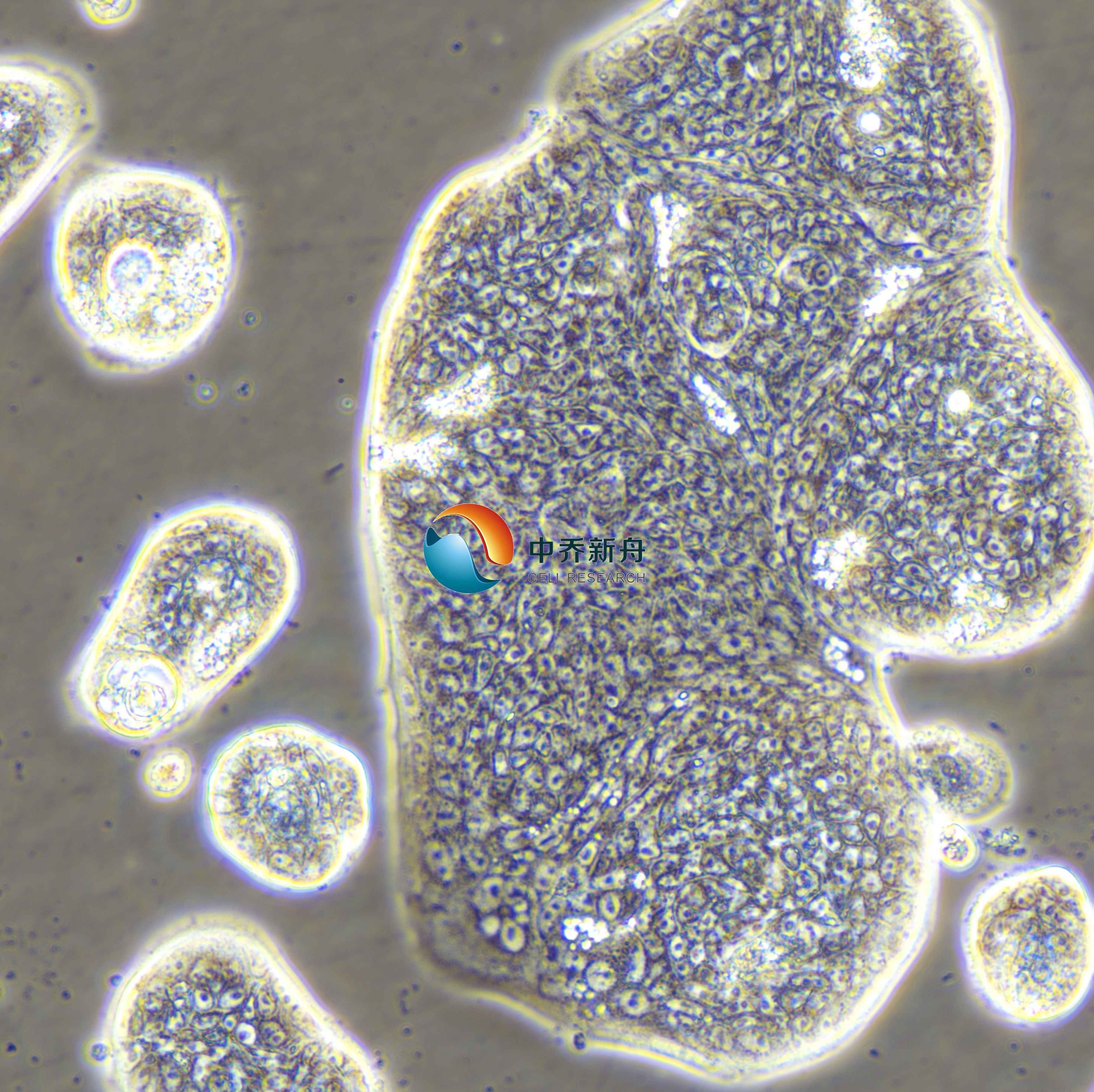 SW1116人结肠腺癌细胞
