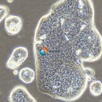 SW1116人结肠腺癌细胞