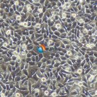 CAL-62人甲状腺癌细胞