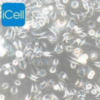 TE-1 | TE-1细胞 | TE1细胞 | TE1 | 人食管癌细胞 | STR鉴定 | 镜像