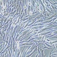 MeWO、MeWO细胞、MeWO细胞、人恶性黑色素瘤细胞/STR鉴定