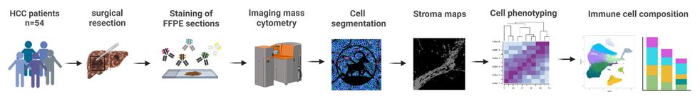 文献解读 | 肝癌免疫组织结构决定免疫疗法预后