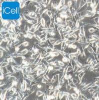 PIEC | PIEC细胞 | PIEC细胞 | PIEC猪髋动脉内皮细胞 | 种属鉴定 | 镜像