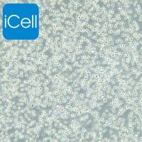 MM.1S+luc、MM.1S细胞、MM.1S细胞、MM.1S、人多发性骨髓瘤细胞稳定表达荧