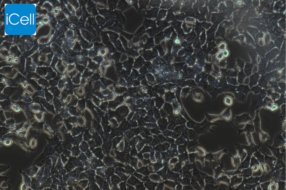 RH-35、RH-35细胞、RH35细胞、RH35、大鼠肝癌