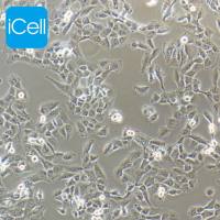 HT-1080 | HT-1080细胞 | HT1080细胞 | HT1080|人纤维肉瘤细胞 | STR鉴定 | 镜像绮点(Cellverse)