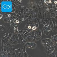 Ishikawa、Ishikawa细胞、Ishikawa细胞、Ishikawa人