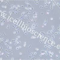 PY8119、PY8119细胞、PY-8119细胞、PY-8119、小鼠恶性乳腺癌细胞/STR鉴定/镜像绮点（Cellverse）