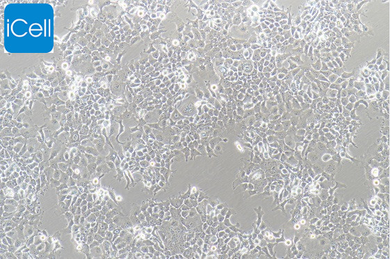 FADU、FADU细胞、FADU人咽鳞癌细胞/STR鉴定