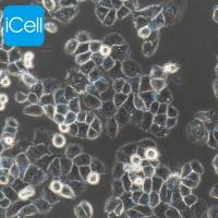 IOSE-80细胞 |IOSE80细胞 |  IOSE-80 | IOSE-80 | 人正常