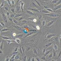 KTC-1人甲状腺癌细胞