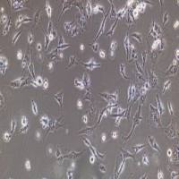 大肠埃希氏菌定量菌株