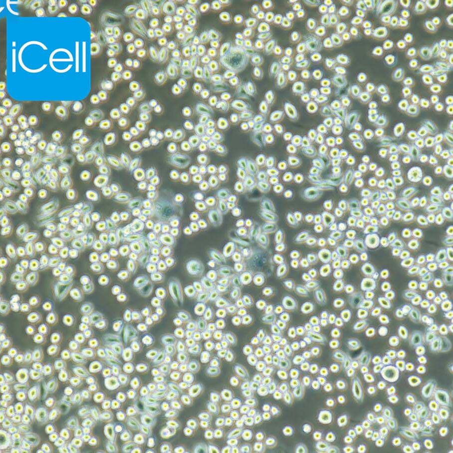 AR42J、AR42J细胞、AR42J细胞、大鼠胰腺外分泌细胞/STR鉴定