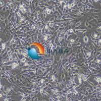 HTh-7人甲状腺癌细胞