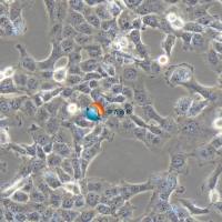 B-CPAP人甲状腺癌细胞