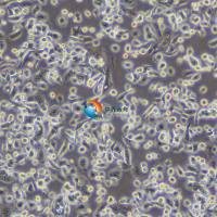 AsPC-1人转移胰腺癌细胞