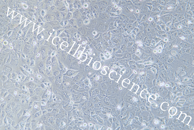 HEY | HEY细胞 | HEY细胞 | 人卵巢癌细胞 |