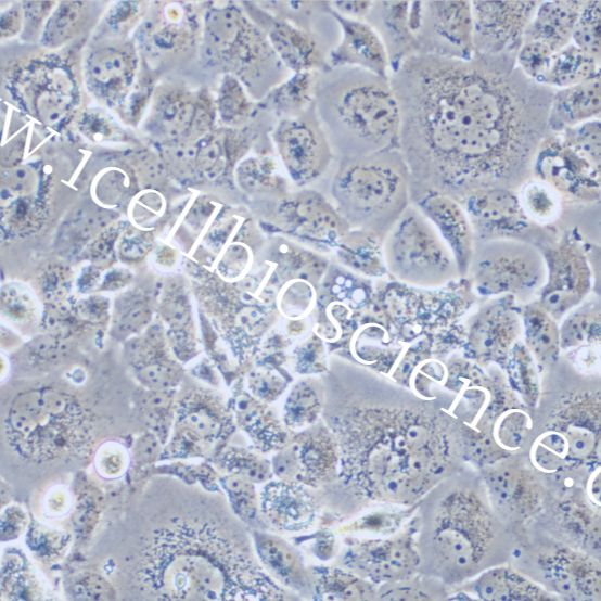 HEY | HEY细胞 | HEY细胞 | 人卵巢癌细胞 | STR鉴定 | 镜像绮点(Cellverse)