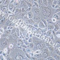 HEY | HEY细胞 | HEY细胞 | 人卵巢癌细胞 | STR鉴定 | 镜像绮点