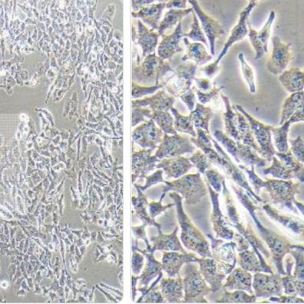 无乳链球菌定量菌株