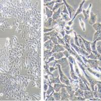 无乳链球菌定量菌株