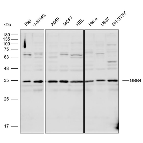 Anti-GNB4 Polyclonal Antibody-实验图片 Anti-GNB4 Polyclonal Antibody-实验图片