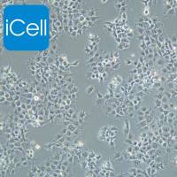 JAR、JAR细胞、JAR细胞、JAR人胎盘绒毛癌细胞/STR鉴定/镜像绮点(Cellverse)